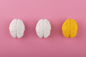 Imagem ilustrativa de cérebros brancos e amarelo, representando a síndrome do x frágil